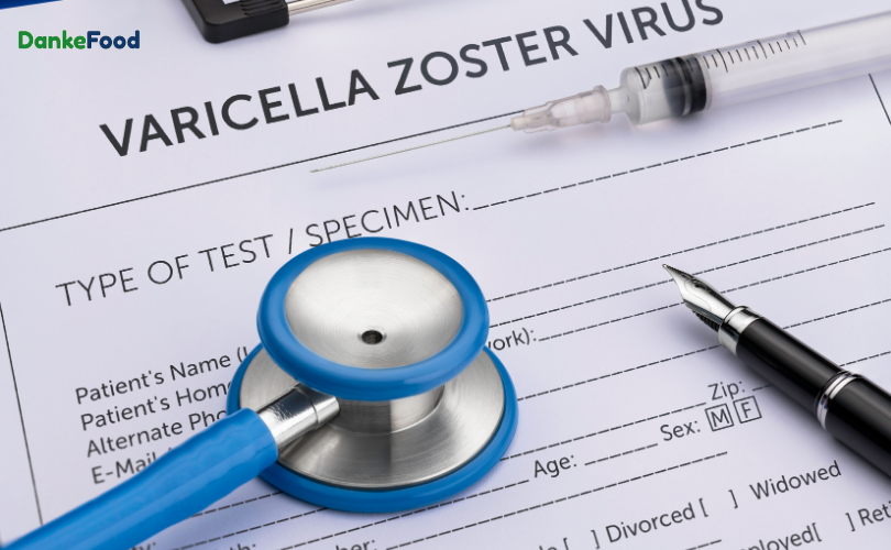 Virus varicella-zoster gây ra bệnh thủy đậu